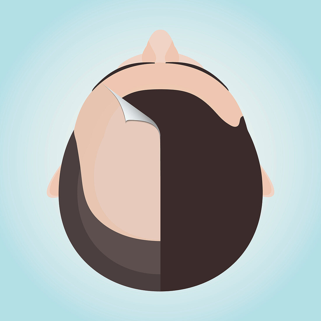 Hair loss treatment for men, conceptual illustration