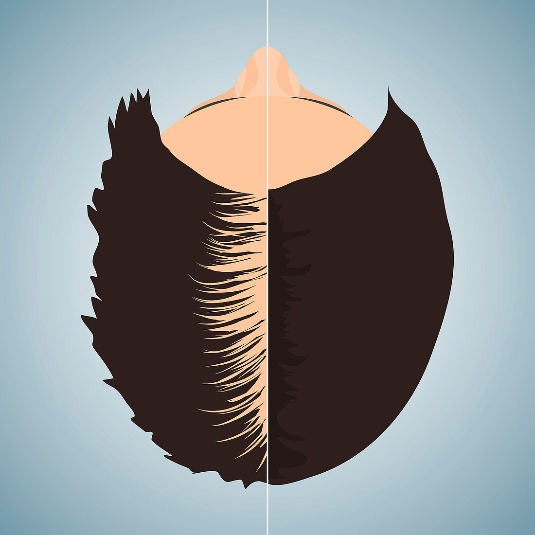 Hair loss treatment for women, conceptual illustration