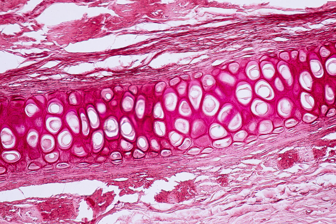 Human cartilage and bone, light micrograph