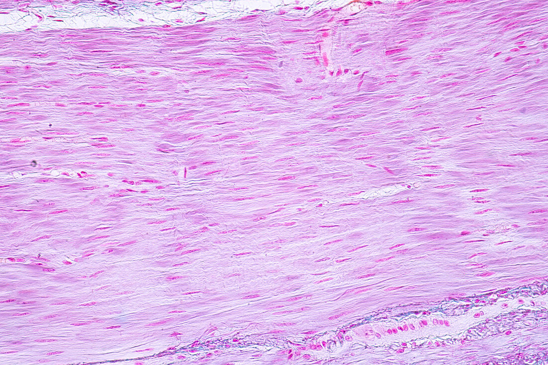 Human smooth muscle, light micrograph