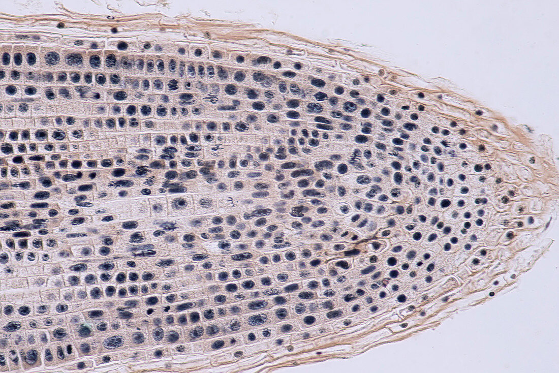 Mitosis, light micrograph