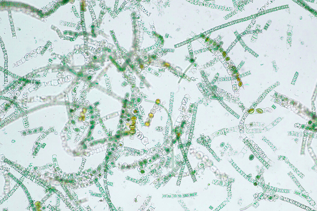 Filamentous algae, light micrograph