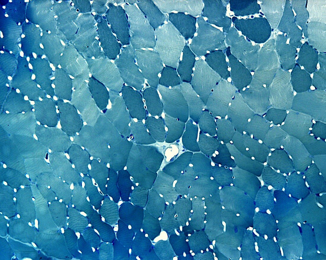 Skeletal muscle vascularization, light micrograph