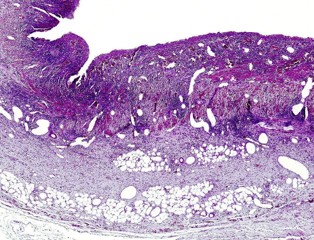 Human granulation tissue, light micrograph