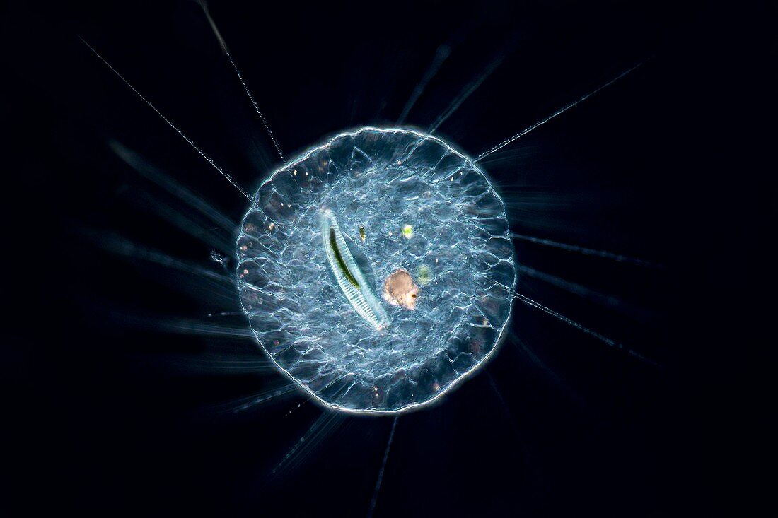Actinosphaerium heliozoan, light micrograph