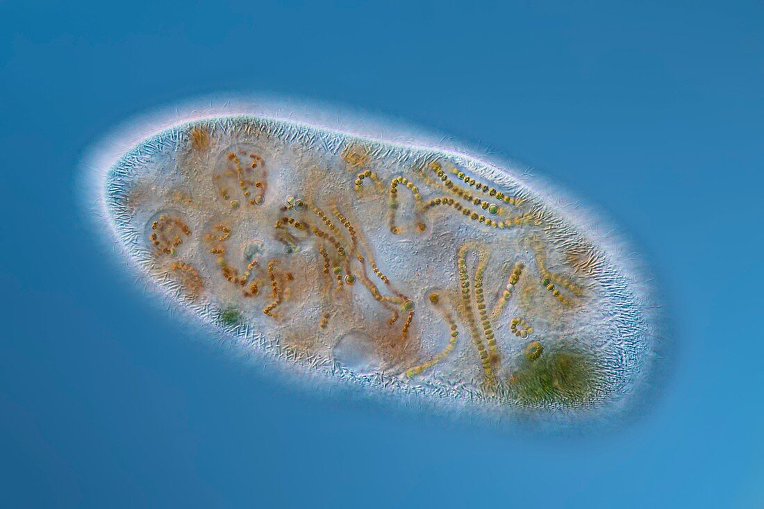 Frontonia protist, light micrograph