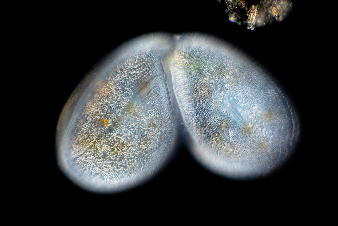 Frontonia protist, light micrograph