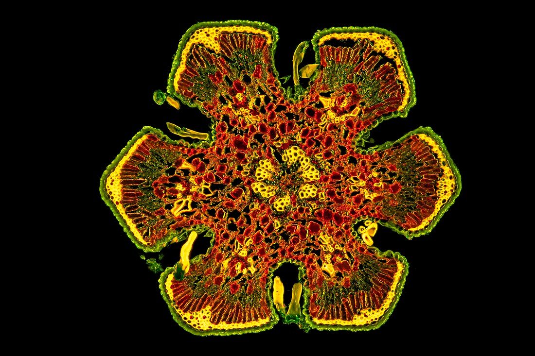 Casuarina tree, fluorescent light micrograph