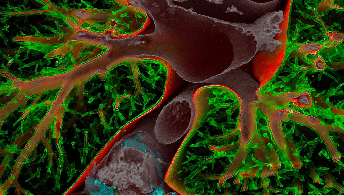 Heart, aorta and lungs, CT scan