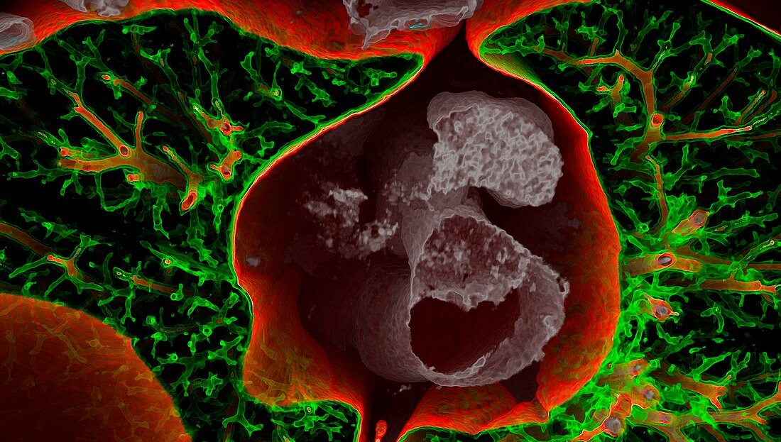 Heart, aorta and lungs, CT scan