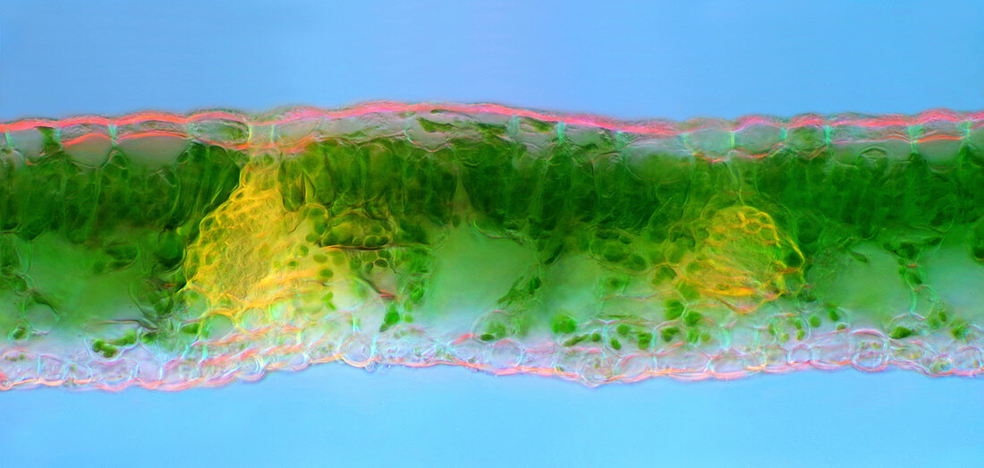Maple leaf, light micrograph