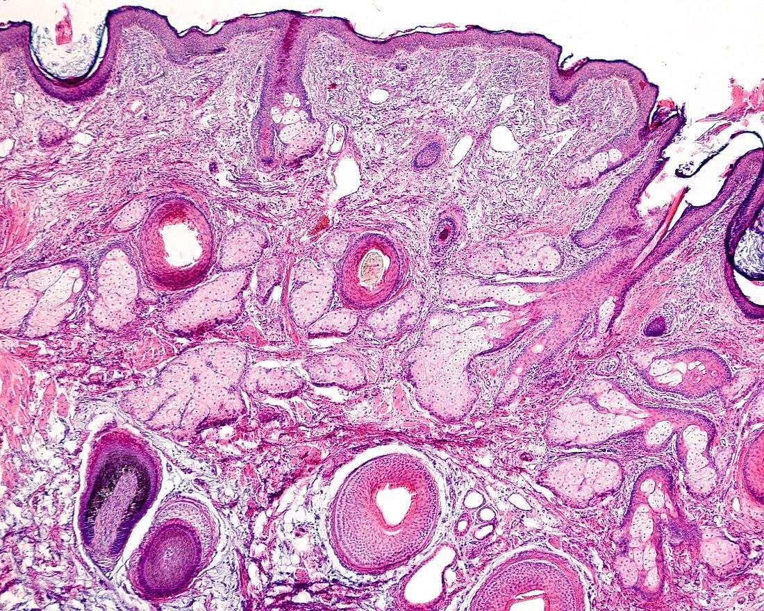 Sebaceous glands, light micrograph