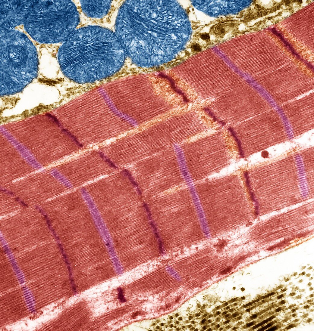 Striated muscle, TEM