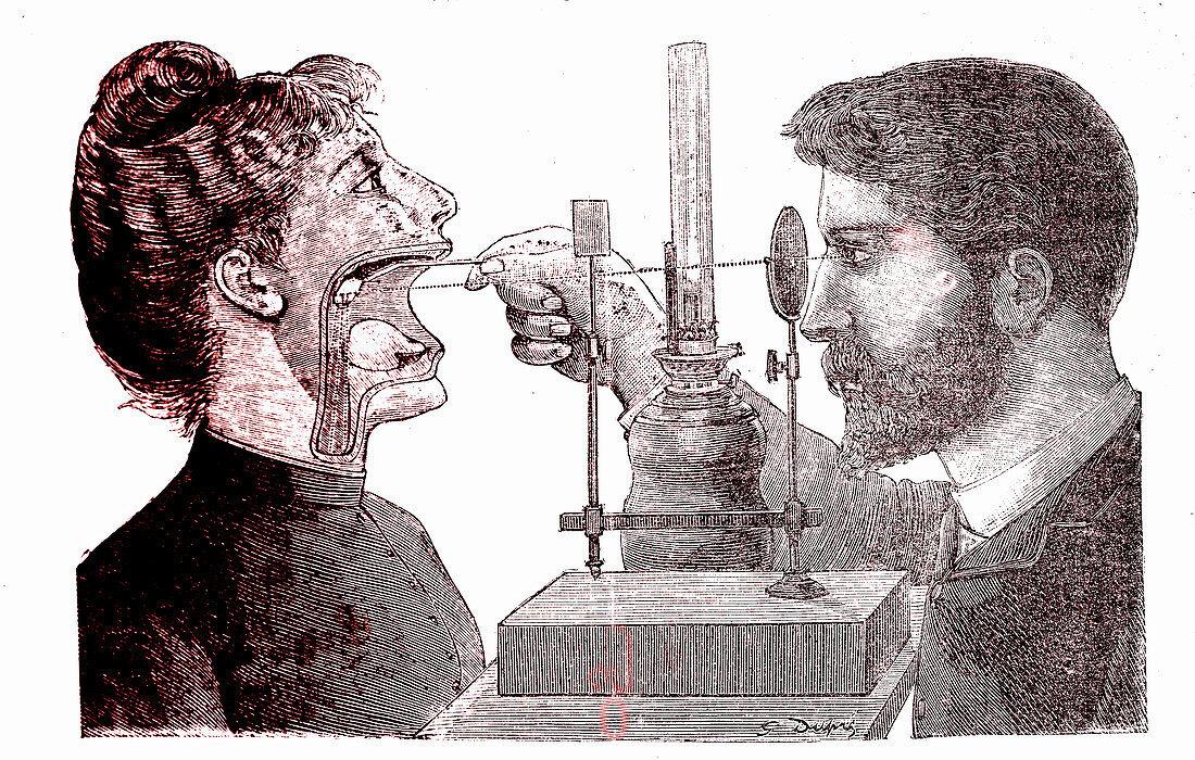 19th Century laryngoscope, illustration