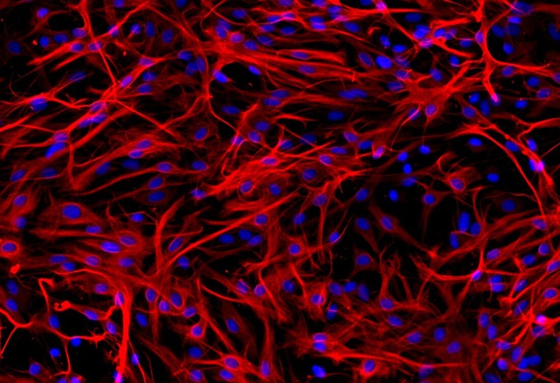 Astrocyte cells, fluorescence light micrograph
