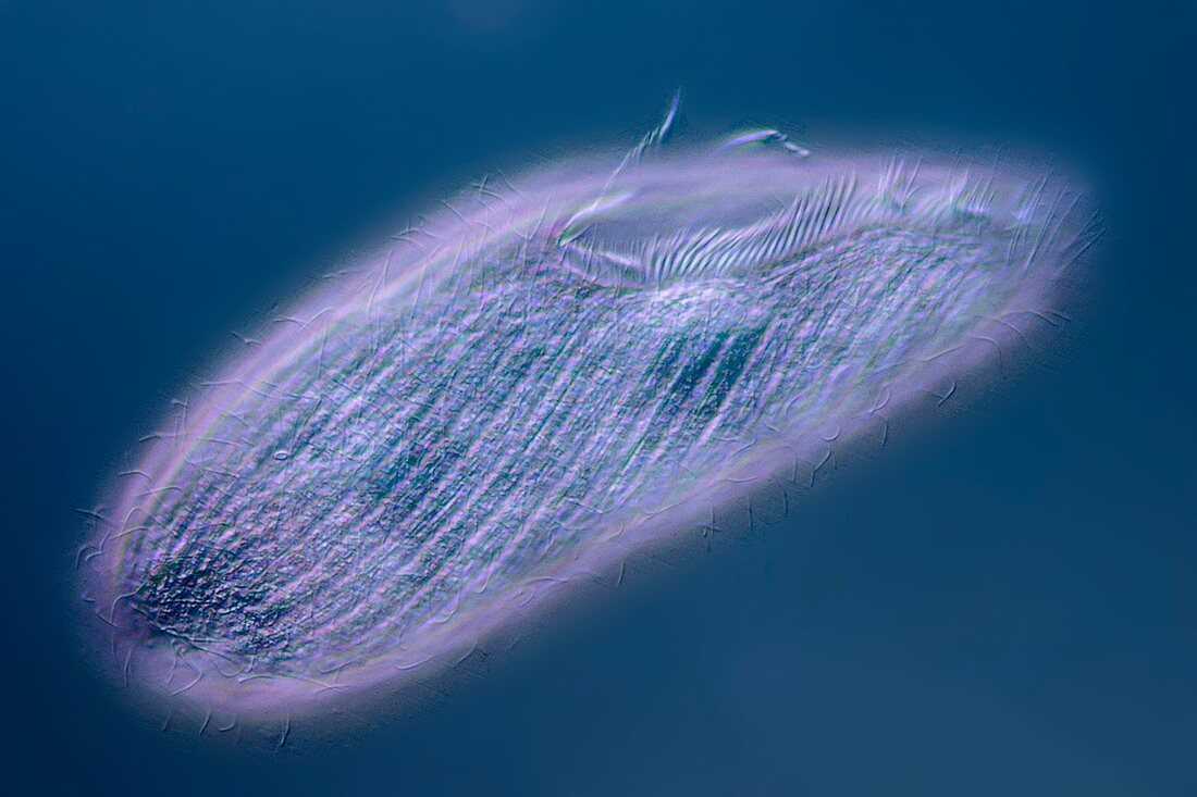 Blepharisma protozoan, light micrograph