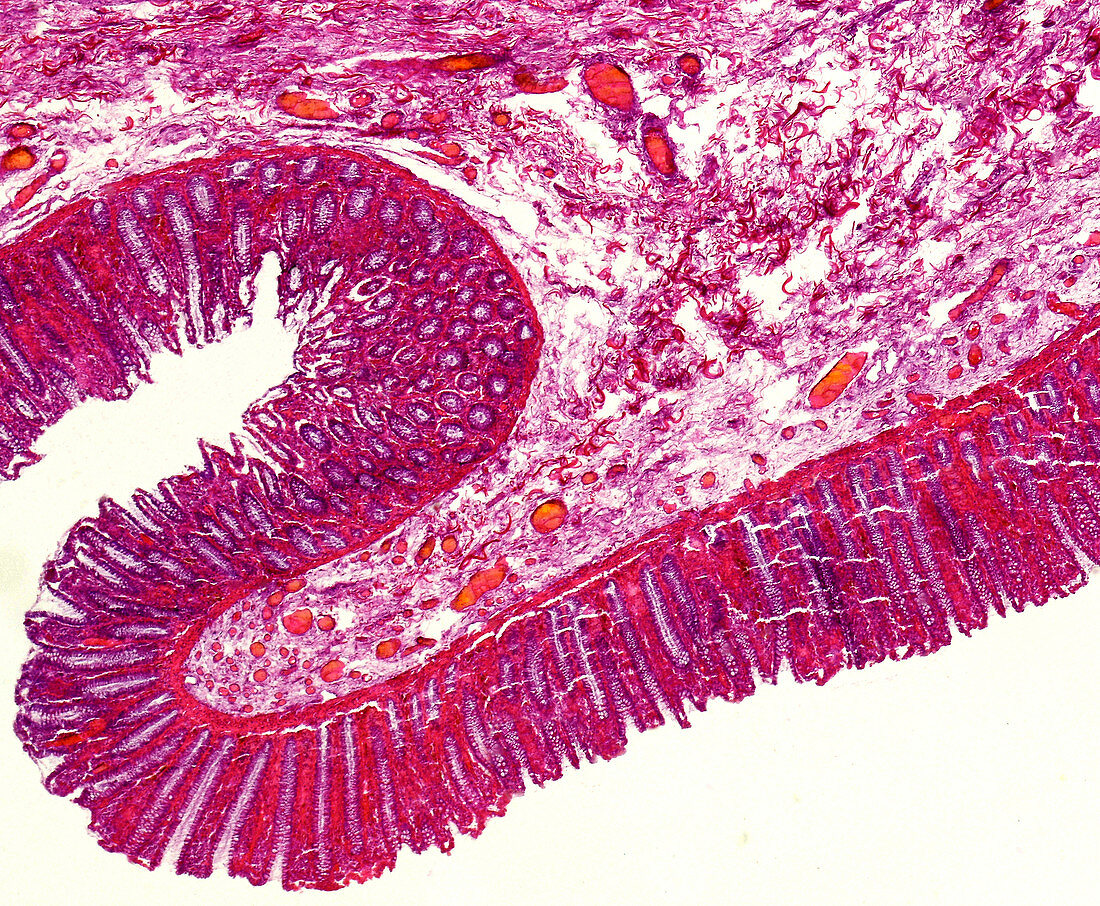 Human colon section, light micrograph