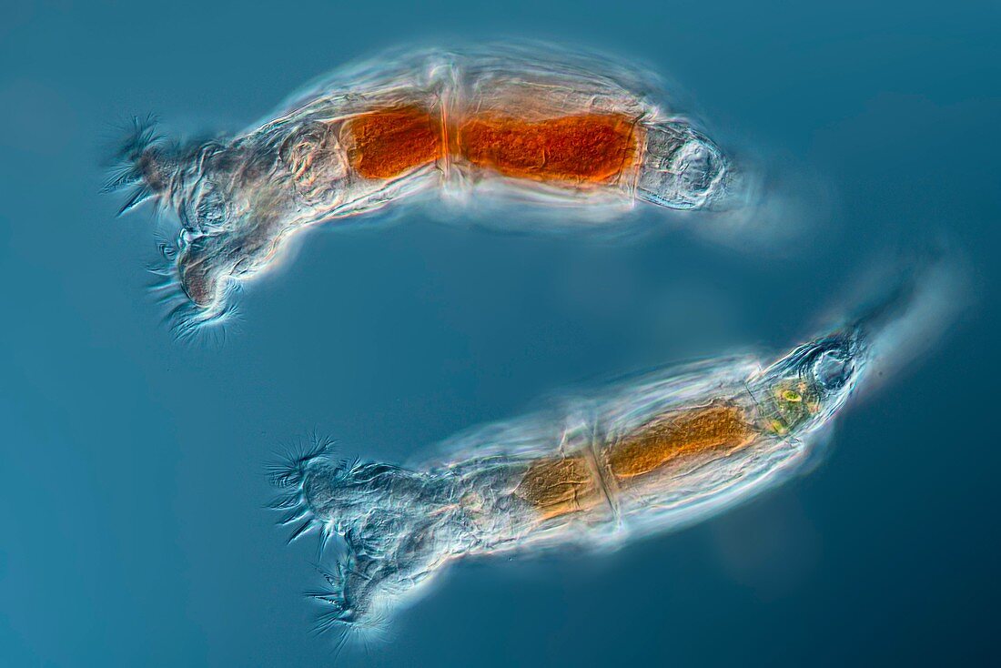Philodina rotifer, light micrograph