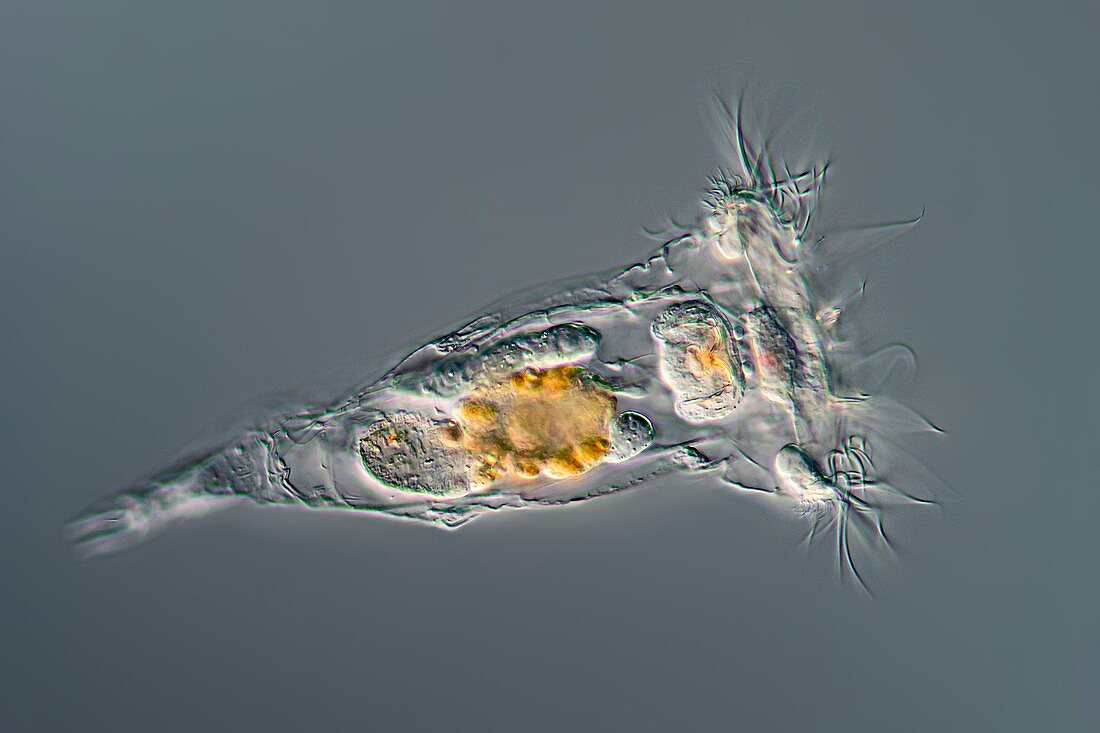 Synchaeta rotifer, light micrograph