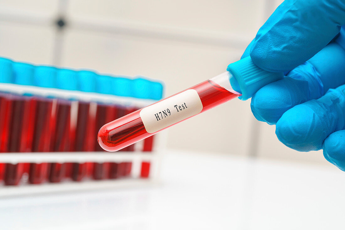 H7N9 avian influenza blood test, conceptual image
