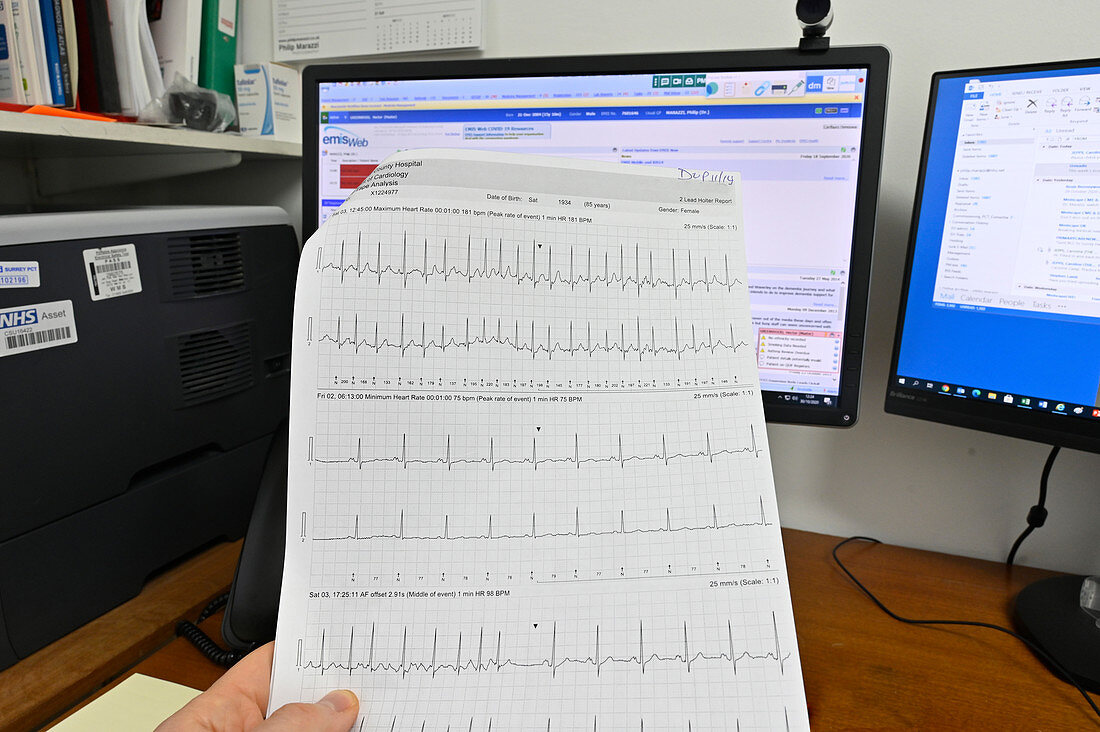 ECG printout showing tachycardia