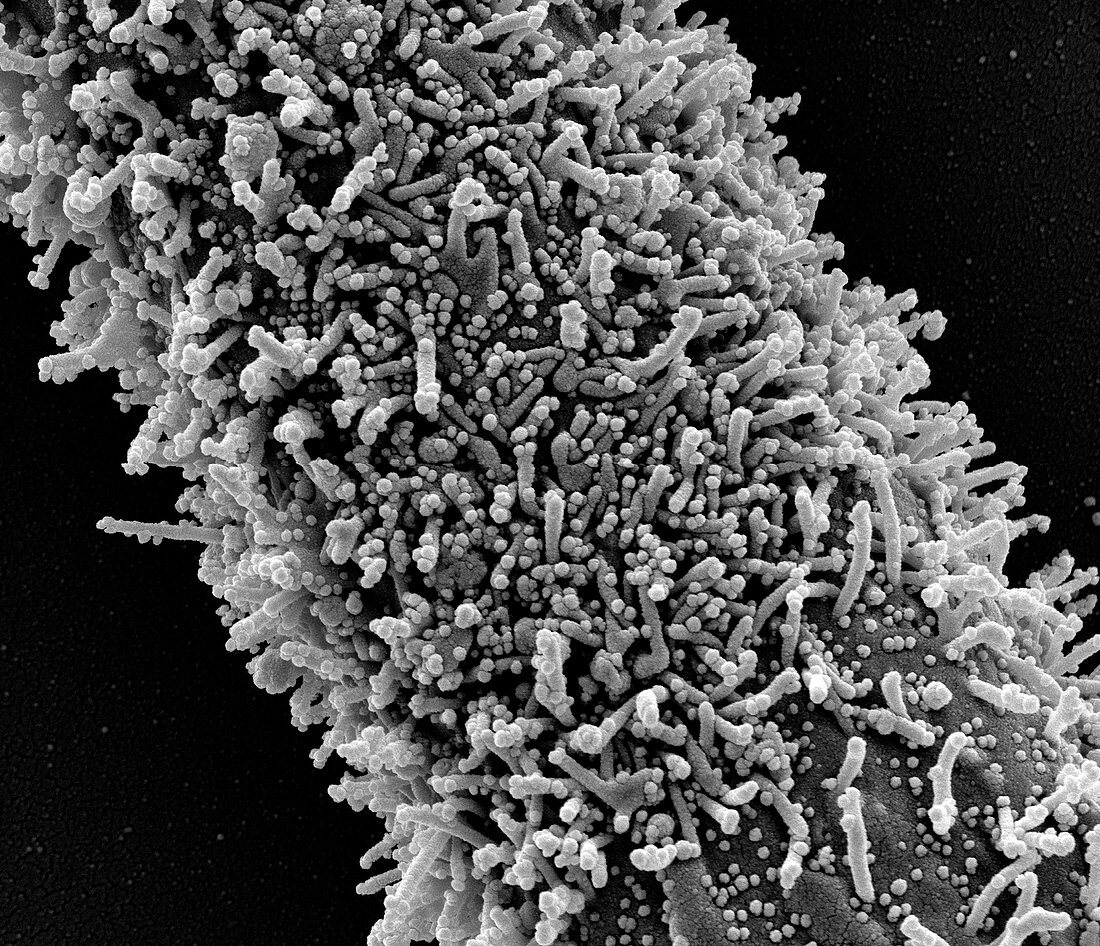 Cell infected by Covid-19 virus particles, SEM