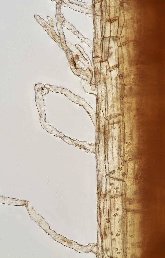 Chrysanthemum root, light micrograph