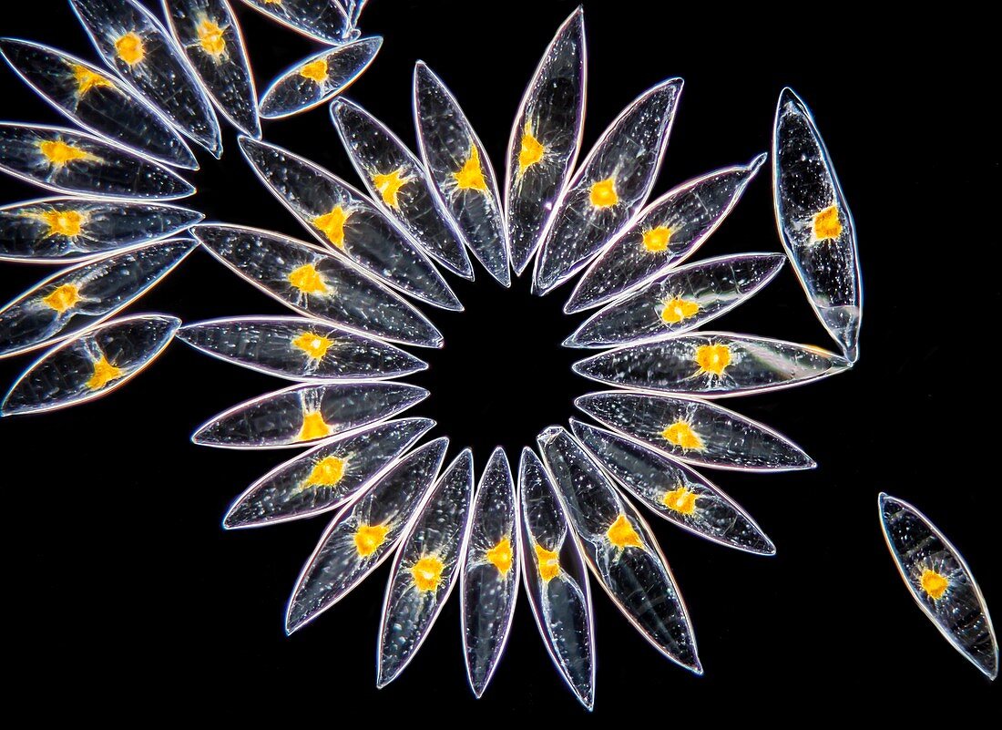 Pyrocystis lunula dinoflagellates, light micrograph