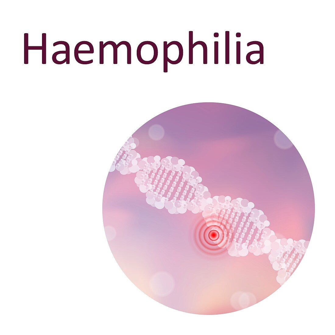 Haemophilia, illustration