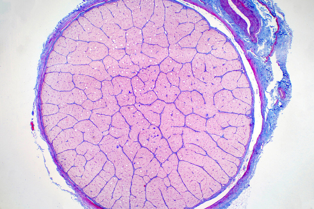 Human optic nerve, light micrograph