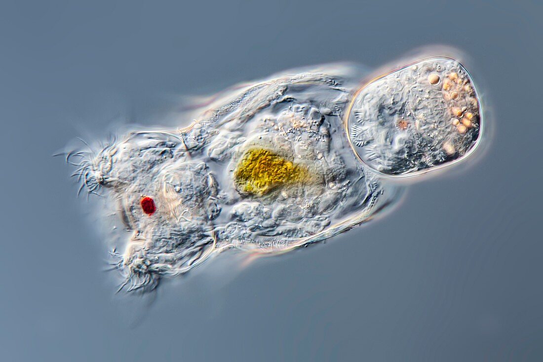 Keratella sp. rotifer, LM