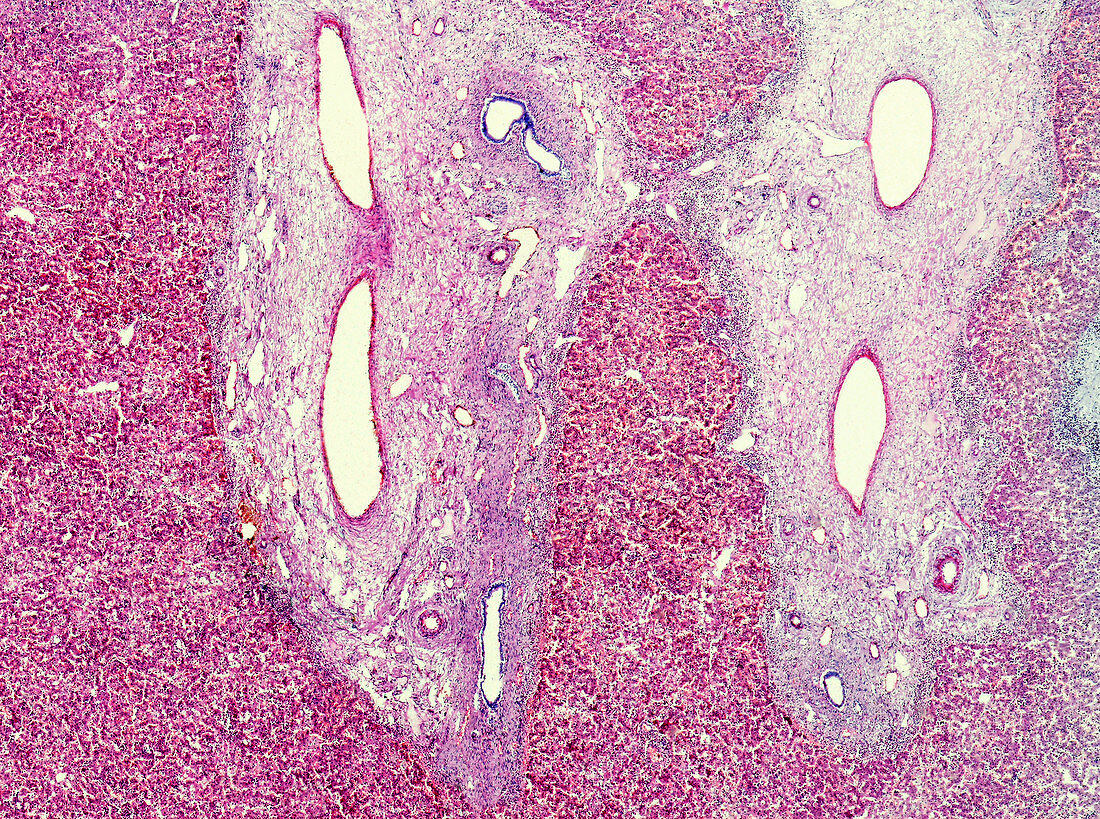 Toxic hepatitis, light micrograph