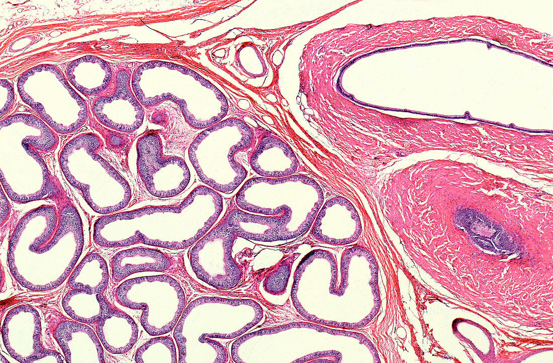 Epididymis section, light micrograph