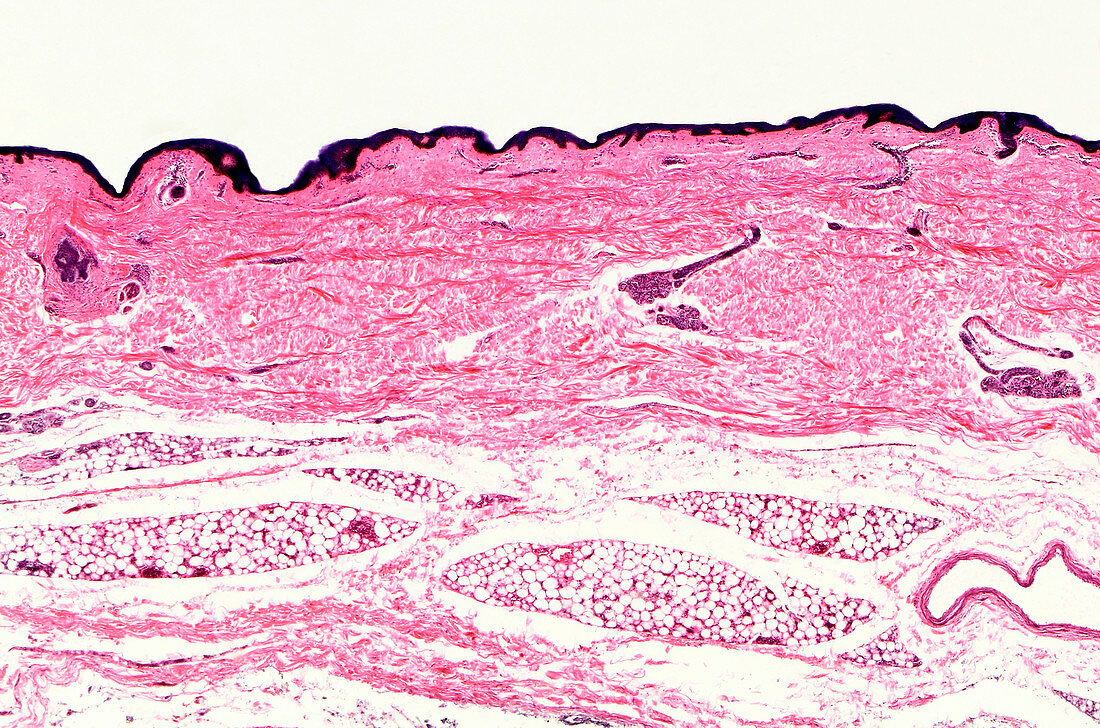 Human eyelid section, light micrograph