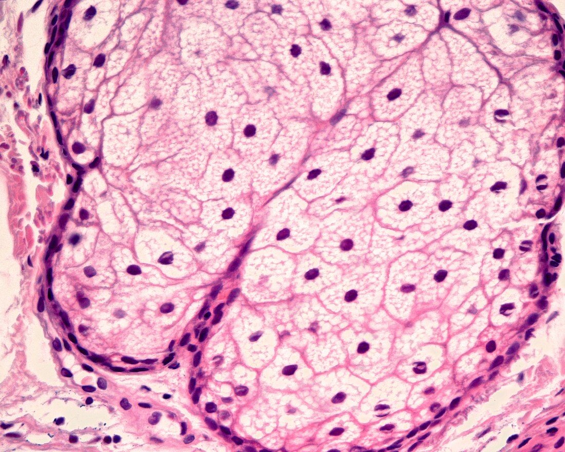 Sebaceous gland, light micrograph