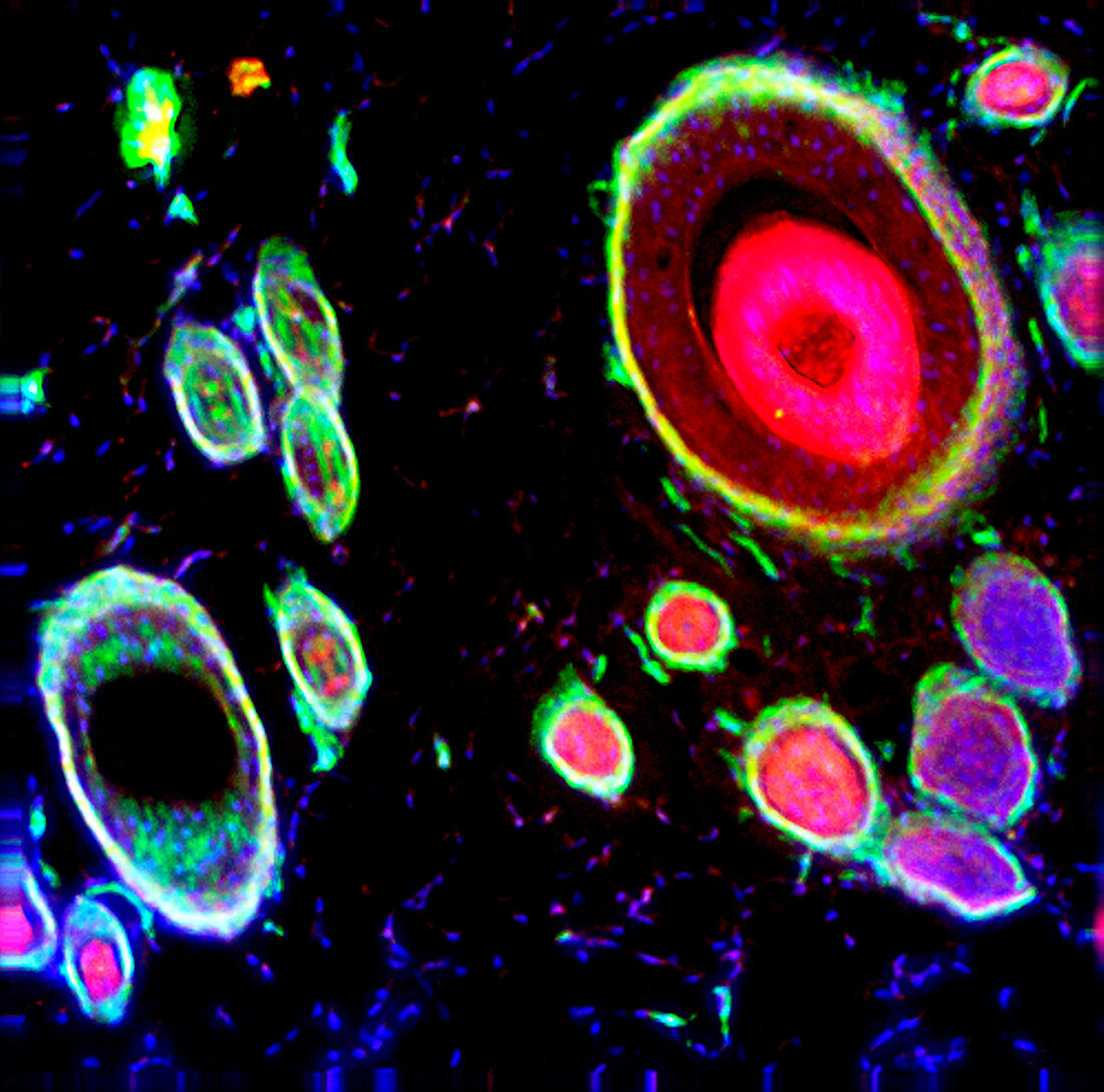 Reticular dermis, fluorescent micrograph