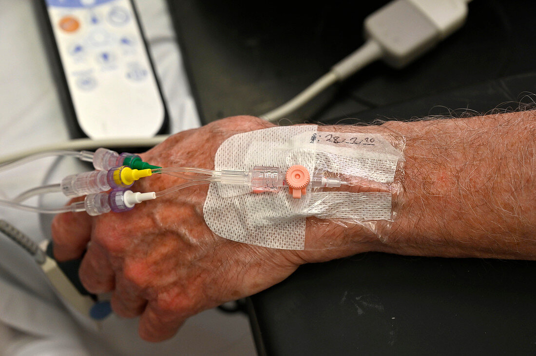Patient's hand during surgery
