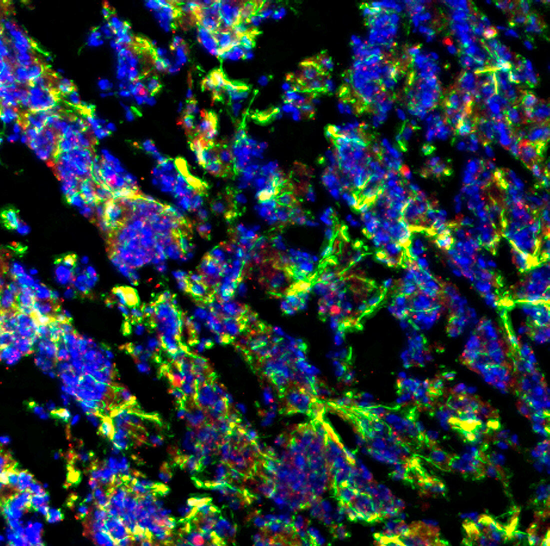 Astrocyte cells, fluorescence micrograph