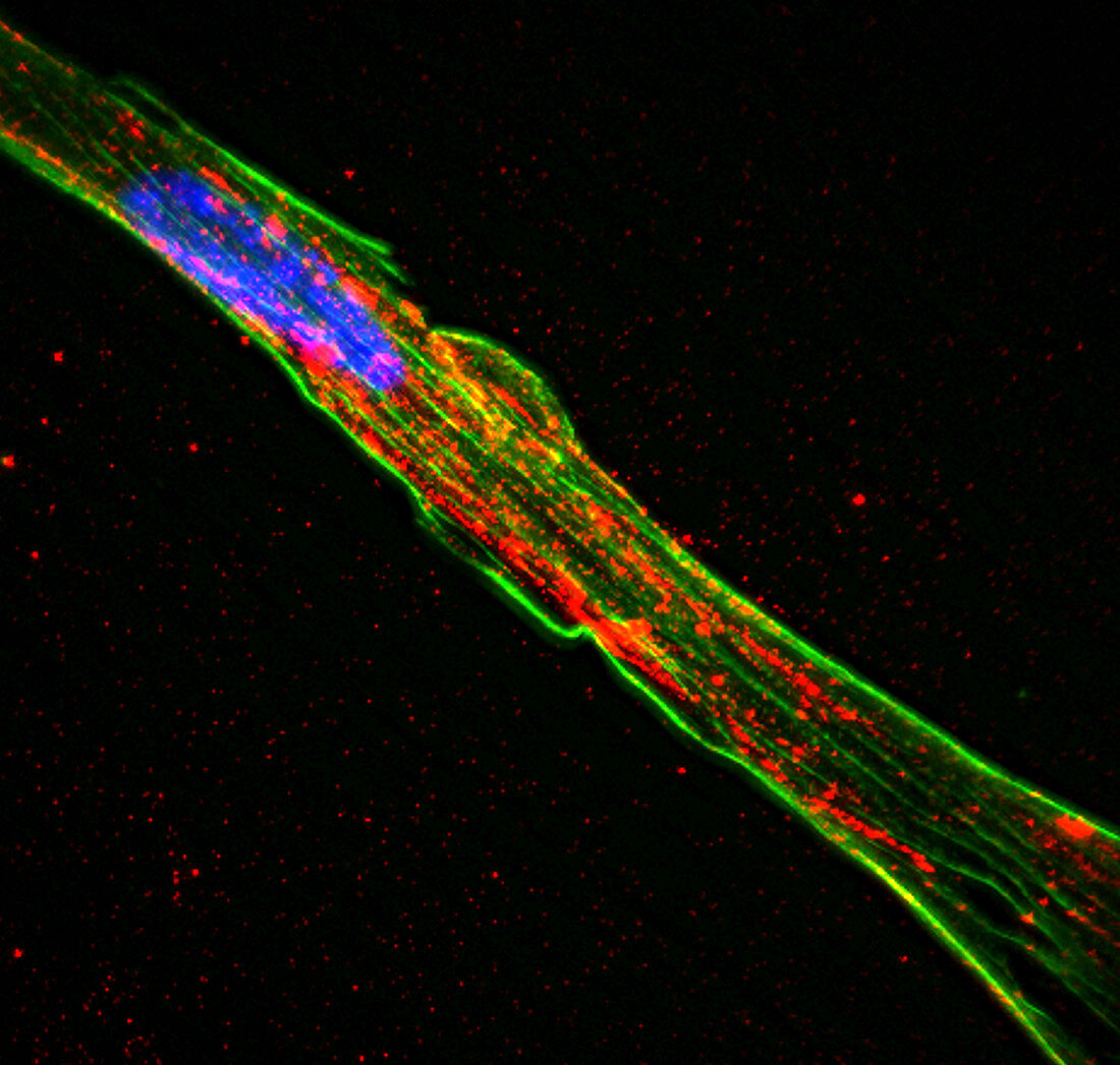 Astrocyte cell, fluorescence micrograph
