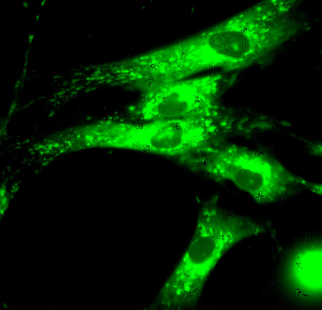 Endoplasmic reticulum, fluorescence micrograph