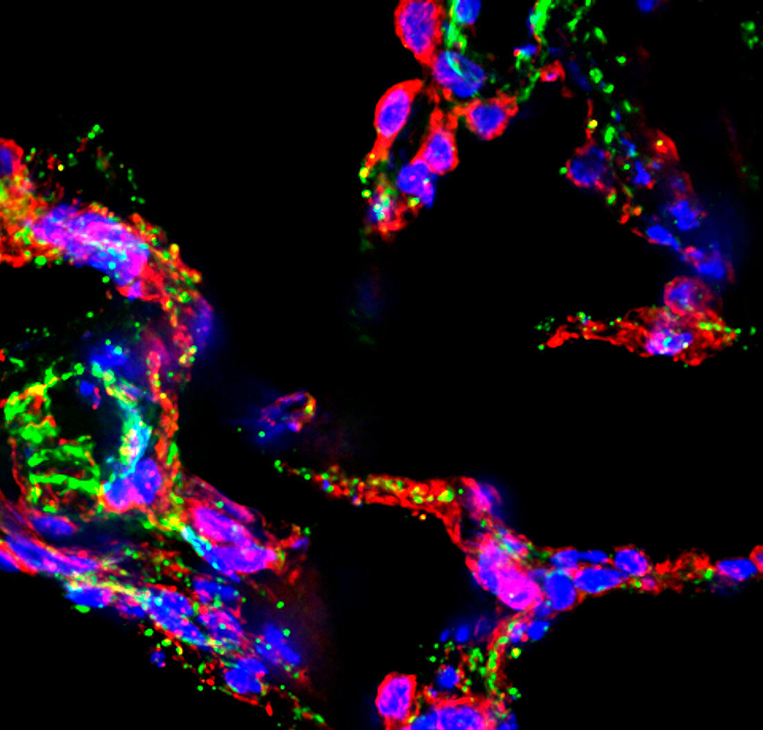 Lung alveoli, fluorescence micrograph