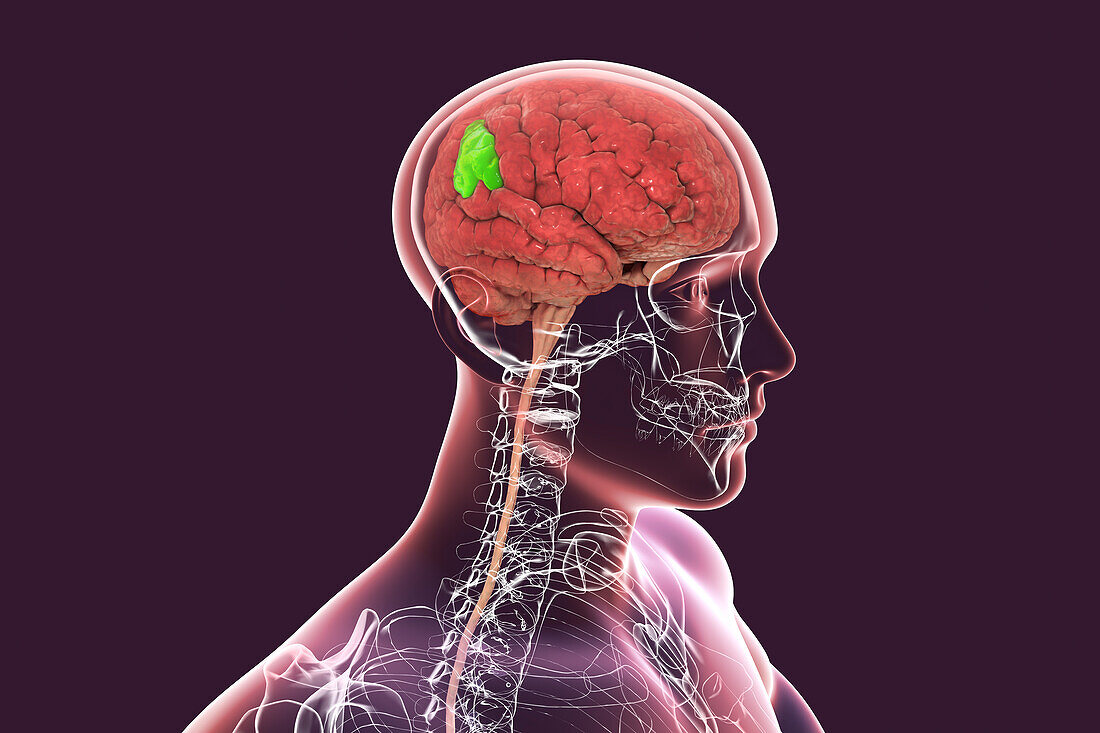 Brain with highlighted supramarginal gyrus, illustration