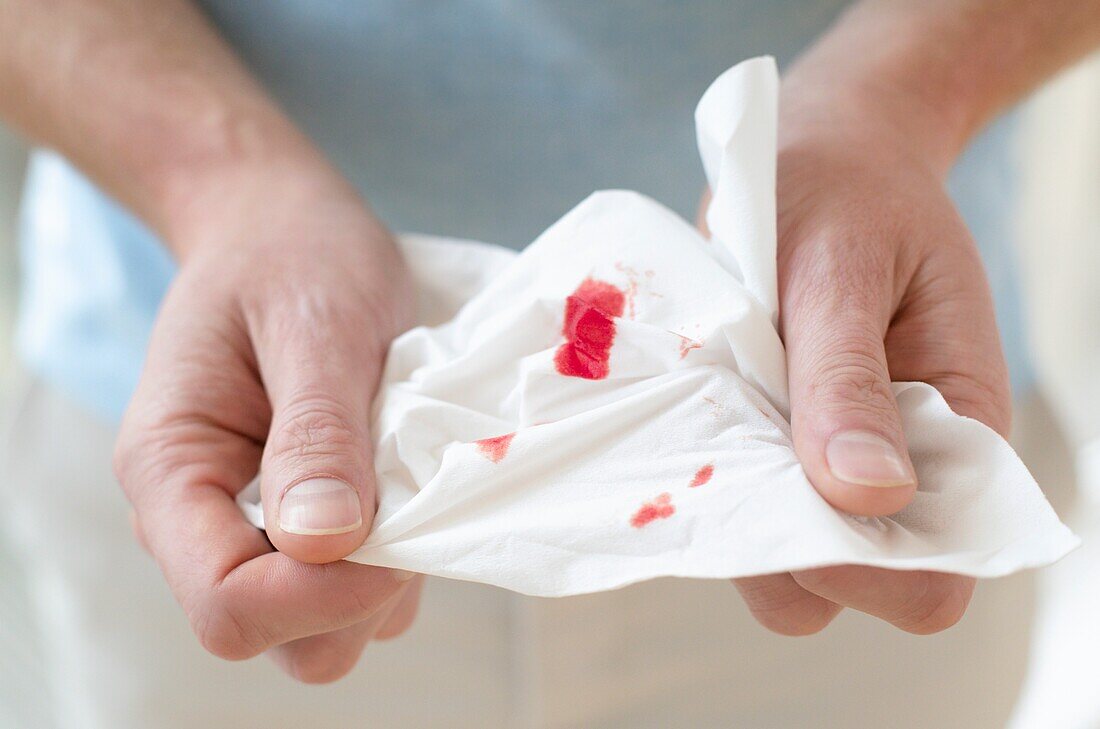 Blood on a tissue