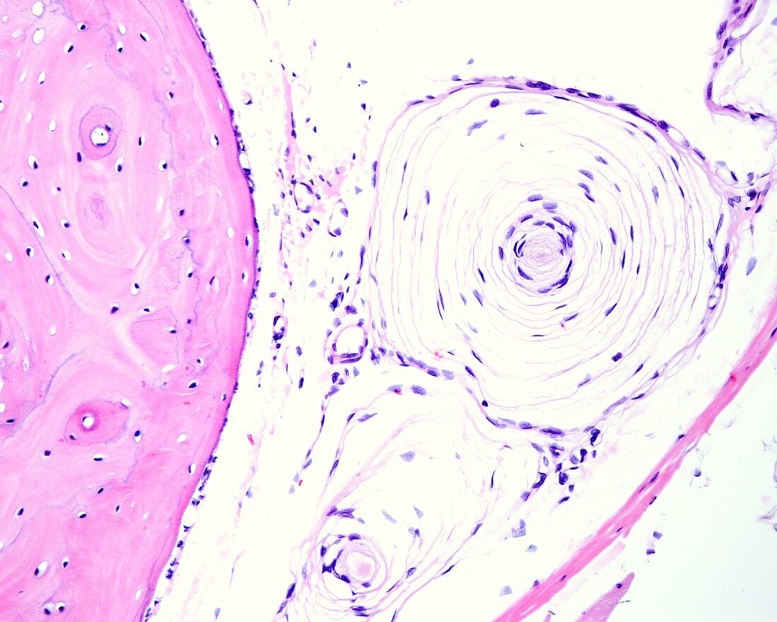 Pacinian corpuscle in periosteum, light micrograph