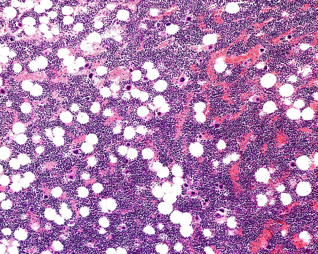 Hematopoietic bone marrow, light micrograph