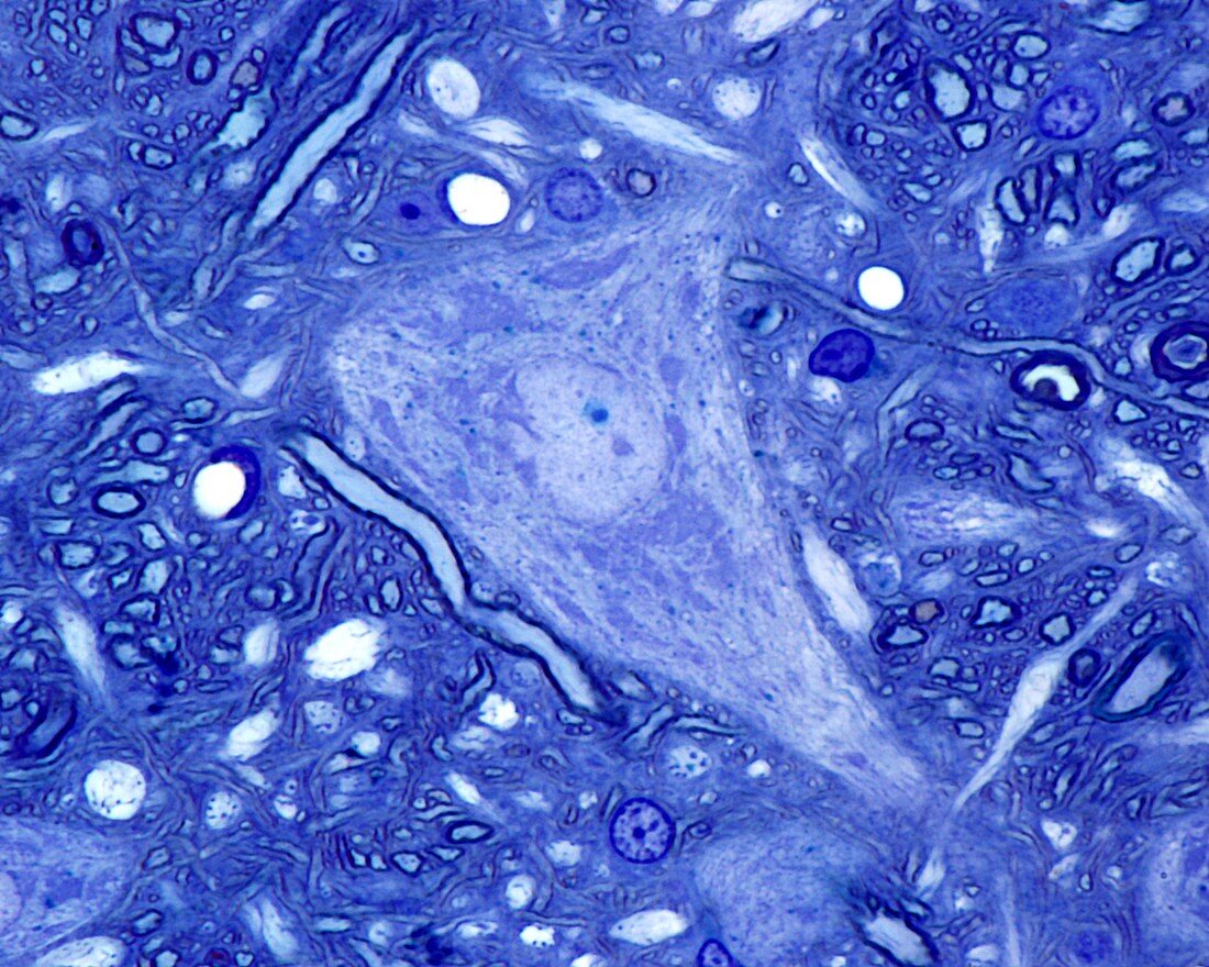 Neuron cell body, light micrograph