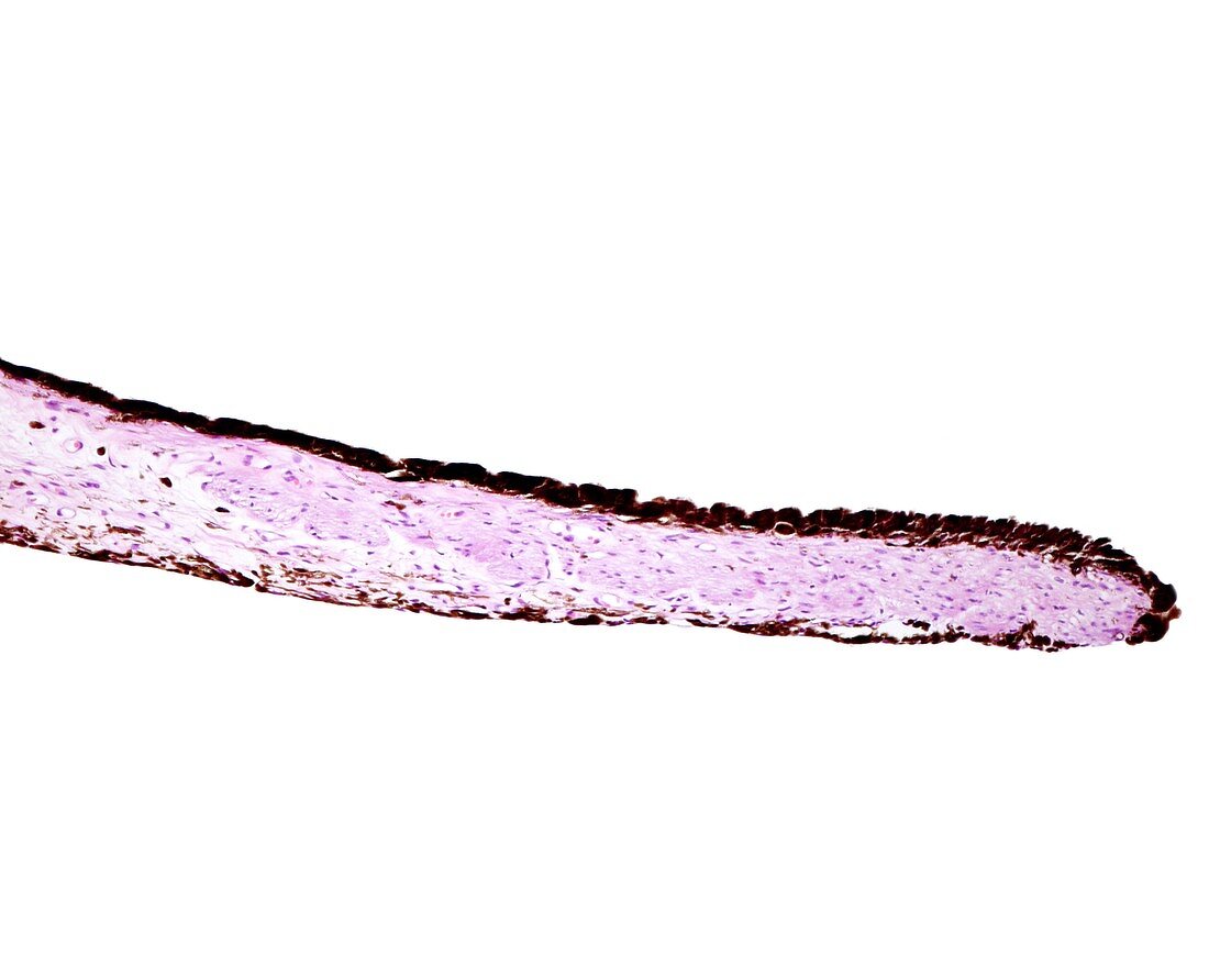 Iris sphincter muscle, light micrograph