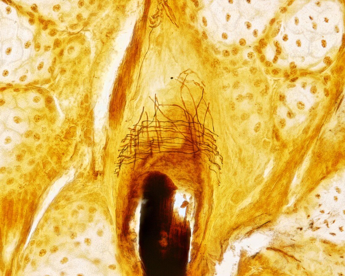 Hair innervation, light micrograph