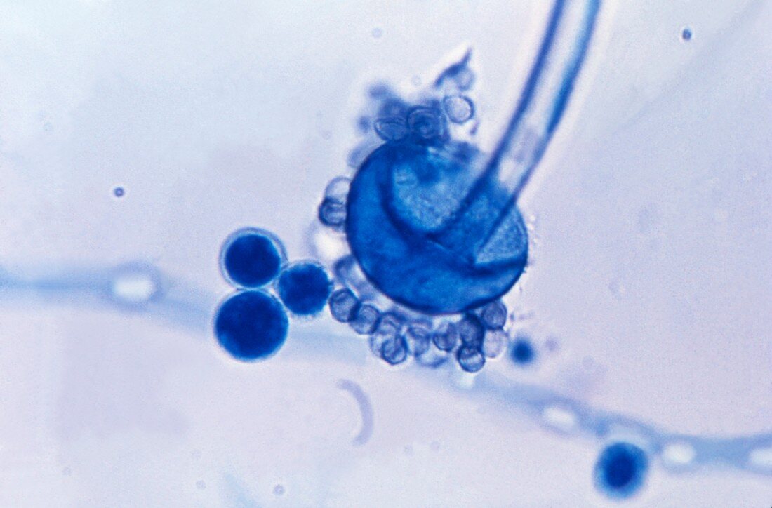Rhizopus oryzae fungus, light micrograph