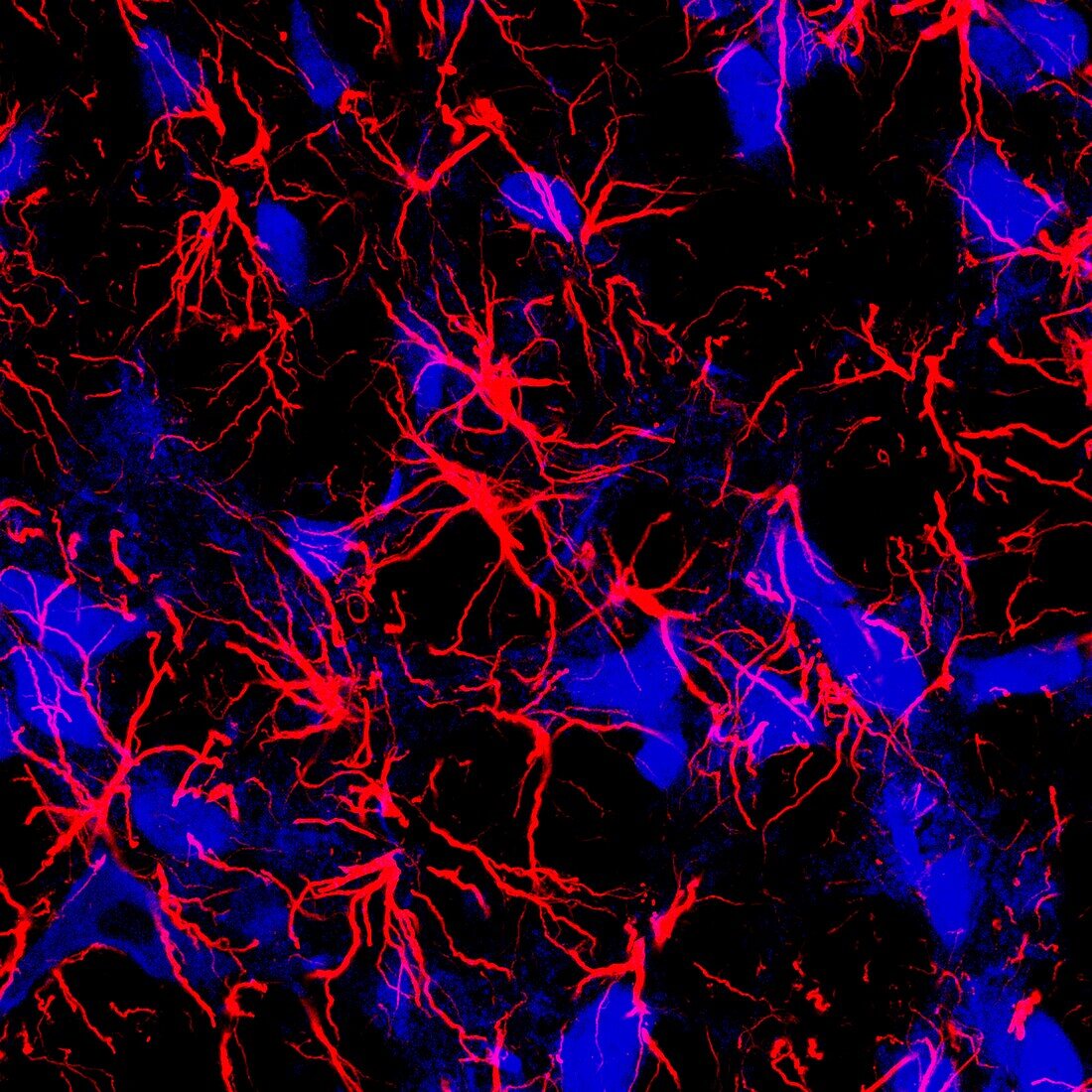 Astrocytes, fluorescent micrograph